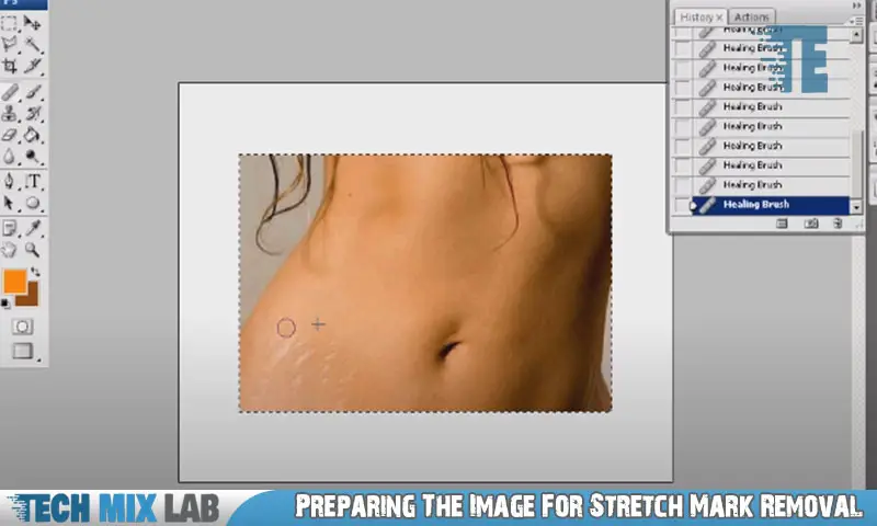 Preparing The Image For Stretch Mark Removal